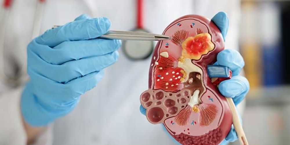 Nephrology